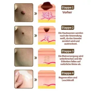 𝑷𝒖𝒓𝒆𝒍𝒐𝒓𝒂® 𝑺𝒄𝒉𝒘𝒂𝒓𝒛 & 𝑾𝒆𝒊𝒔𝒔 𝑹𝒆𝒊𝒔 𝑫𝒖𝒂𝒍-𝑹𝒆𝒏𝒆𝒘𝒂𝒍 𝑪𝒓𝒆𝒎𝒆