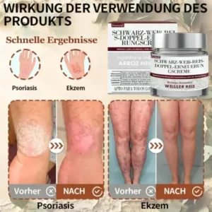 𝑷𝒖𝒓𝒆𝒍𝒐𝒓𝒂® 𝑺𝒄𝒉𝒘𝒂𝒓𝒛 & 𝑾𝒆𝒊𝒔𝒔 𝑹𝒆𝒊𝒔 𝑫𝒖𝒂𝒍-𝑹𝒆𝒏𝒆𝒘𝒂𝒍 𝑪𝒓𝒆𝒎𝒆