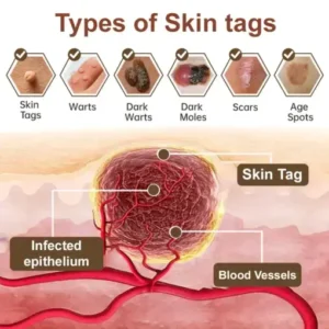 𝑷𝒖𝒓𝒆𝒍𝒐𝒓𝒂® 𝑩𝒍𝒂𝒄𝒌 & 𝑾𝒉𝒊𝒕𝒆 𝑹𝒊𝒄𝒆 𝑫𝒖𝒂𝒍 𝑹𝒆𝒏𝒆𝒘𝒂𝒍 𝑪𝒓𝒆𝒂𝒎