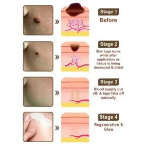 𝑷𝒖𝒓𝒆𝒍𝒐𝒓𝒂® 𝑩𝒍𝒂𝒄𝒌 & 𝑾𝒉𝒊𝒕𝒆 𝑹𝒊𝒄𝒆 𝑫𝒖𝒂𝒍 𝑹𝒆𝒏𝒆𝒘𝒂𝒍 𝑪𝒓𝒆𝒂𝒎