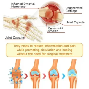 𝑃𝑢𝑟𝑒𝑙𝑜𝑟𝑎® 𝐴𝑑𝑣𝑎𝑛𝑐𝑒𝑑 𝐵𝑒𝑒 𝑉𝑒𝑛𝑜𝑚 𝐽𝑜𝑖𝑛𝑡 𝑇ℎ𝑒𝑟𝑎𝑝𝑦 𝐶𝑟𝑒𝑎𝑚