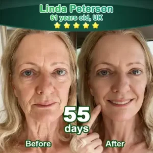 𝗣𝘂𝗿𝗲𝗹𝗼𝗿𝗮® 𝗦𝘁𝗲𝗺 𝗖𝗲𝗹𝗹–𝗔𝗰𝘁𝗶𝘃𝗮𝘁𝗲𝗱 𝗖𝗼𝗹𝗹𝗮𝗴𝗲𝗻 𝗣𝗲𝗽𝘁𝗶𝗱𝗲 𝗱𝗿𝗼𝗽𝘀