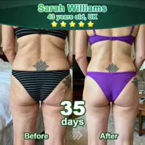 𝗣𝘂𝗿𝗲𝗹𝗼𝗿𝗮® 𝗦𝘁𝗲𝗺 𝗖𝗲𝗹𝗹–𝗔𝗰𝘁𝗶𝘃𝗮𝘁𝗲𝗱 𝗖𝗼𝗹𝗹𝗮𝗴𝗲𝗻 𝗣𝗲𝗽𝘁𝗶𝗱𝗲 𝗱𝗿𝗼𝗽𝘀