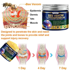 𝗙𝗗𝗔 𝗖𝗲𝗿𝘁𝗶𝗳𝗶𝗲𝗱 · 𝗢𝗳𝗳𝗶𝗰𝗶𝗮𝗹 𝗦𝘁𝗼𝗿𝗲 | Purelora®🔥 BEE VENOM LITHOSPERMUM Pain-Relief Bone Healing Cream 👑👑(Specially for older adults)