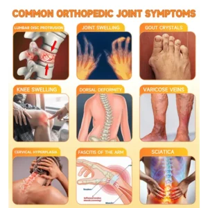 𝗙𝗗𝗔 𝗖𝗲𝗿𝘁𝗶𝗳𝗶𝗲𝗱 · 𝗢𝗳𝗳𝗶𝗰𝗶𝗮𝗹 𝗦𝘁𝗼𝗿𝗲 | Purelora®🔥 BEE VENOM LITHOSPERMUM Pain-Relief Bone Healing Cream 👑👑(Specially for older adults)