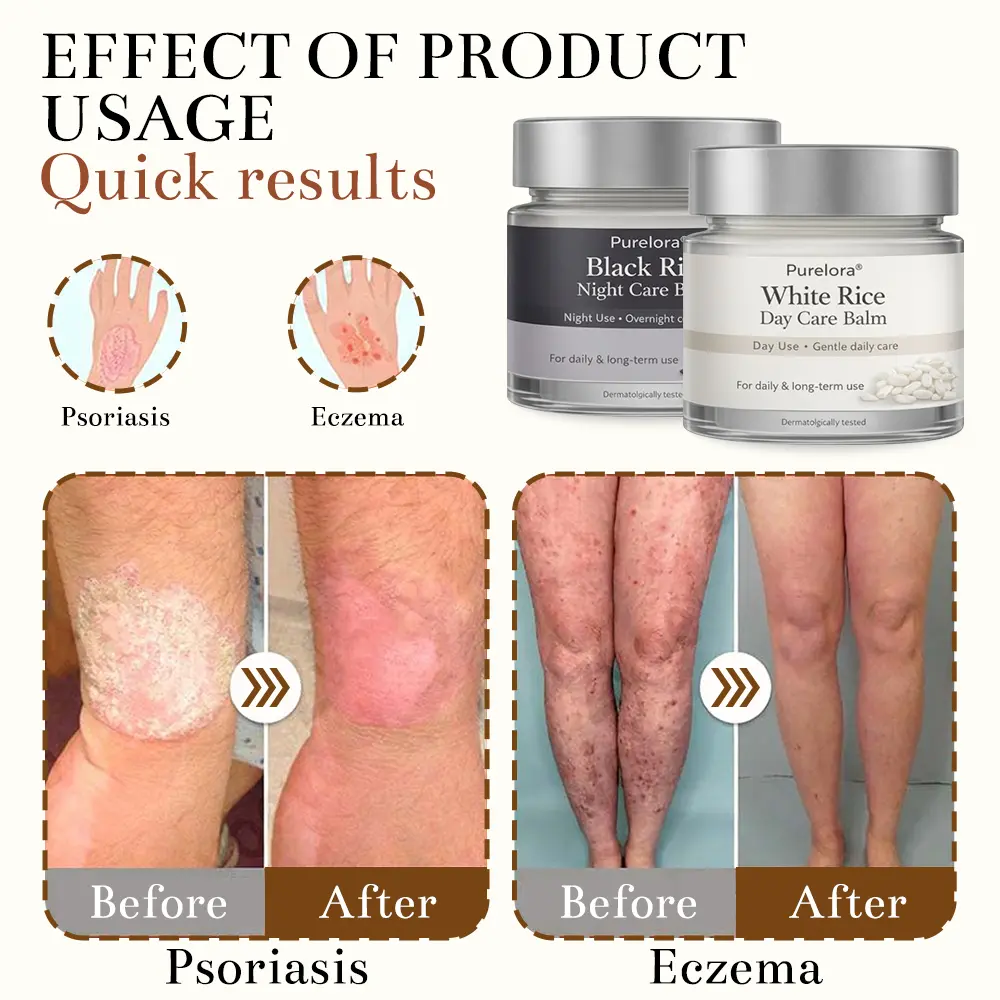 🇺🇸 FDA Certified | Purelora® Black and White Rice Day and Night Dual Repair Cream (Delays aging, repairs skin, removes warts, skin tags, and keratin buildup, providing 24-hour care for your skin)