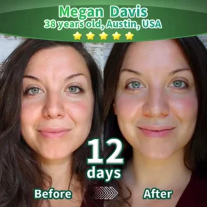 💖Change from the inside out | Purelora® Stem Cell–Derived EGF & Copper Peptide Activating Serum  (Deeply activates skin renewal from within for firmer, smoother-looking skin)