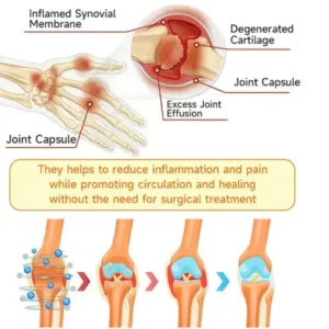 Purelora® BEE VENOM LITHOSPERMUM Pain-Relief Bone Healing Cream