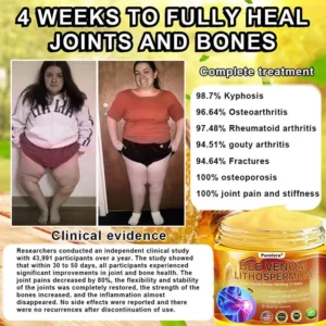 🐝Purelora® Bee Venom & Lithospermum Comfort Cream When Walking, Standing or Sleeping Hurts — Daily Pain Relief & Bone Comfort for Older Adults