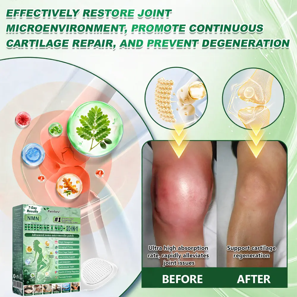 ๐Online Pharmacy ๐ | ๐๐ฎ๐ซ๐๐ฅ๐จ๐ซ๐ยฎ ๐๐๐ ๐๐๐๐๐๐๐๐๐ ๐ฑ ๐๐๐ ๐๐-๐ข๐ง-๐ ๐๐๐ฏ๐๐ง๐๐๐ ๐๐๐ง๐จ ๐๐ข๐๐ซ๐จ๐ง๐๐๐๐ฅ๐ ๐๐๐ญ๐๐ก (Just once daily, visible changes in 7 days) โ
Supports weight management, loose skin, diabetes care, sleep apnea, joint comfort, and more