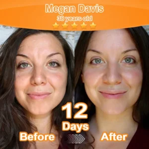 Purelora® Stem Cell Extract EGF and Copper Peptide Revitalizing Essence Cream (deeply activates the skin's internal regeneration, making the skin firmer and smoother)