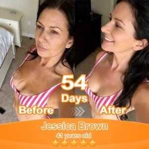 Purelora® Stem Cell Extract EGF and Copper Peptide Revitalizing Essence Cream (deeply activates the skin's internal regeneration, making the skin firmer and smoother)