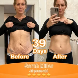 Purelora® Stem Cell Extract EGF and Copper Peptide Revitalizing Essence Cream (deeply activates the skin's internal regeneration, making the skin firmer and smoother)