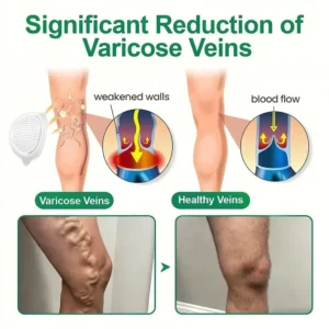 𝐎𝐟𝐟𝐢𝐜𝐢𝐚𝐥 𝐒𝐭𝐨𝐫𝐞|𝐏𝐮𝐫𝐞𝐥𝐨𝐫𝐚® 𝐌𝐞𝐭𝐚𝐛𝐨𝐥𝐢𝐜 𝐌𝐚𝐭𝐫𝐢𝐱™ – 𝐃𝐇𝐁 + 𝐀𝐦𝐚𝐫𝐚𝐬𝐚𝐭𝐞 𝟏𝟎-𝐢𝐧-𝟏 𝐍𝐚𝐧𝐨 𝐌𝐢𝐜𝐫𝐨𝐧𝐞𝐞𝐝𝐥𝐞 𝐏𝐚𝐭𝐜𝐡 (💧𝐉𝐮𝐬𝐭 𝐎𝐧𝐜𝐞 𝐚 𝐃𝐚𝐲 – 𝐕𝐢𝐬𝐢𝐛𝐥𝐞 𝐑𝐞𝐬𝐮𝐥𝐭𝐬 𝐢𝐧 𝟕 𝐃𝐚𝐲𝐬!) ✅𝐓𝐚𝐜𝐤𝐥𝐞𝐬 𝐨𝐛𝐞𝐬𝐢𝐭𝐲, 𝐥𝐨𝐨𝐬𝐞 𝐬𝐤𝐢𝐧, 𝐝𝐢𝐚𝐛𝐞𝐭𝐞𝐬, 𝐬𝐥𝐞𝐞𝐩 𝐢𝐬𝐬𝐮𝐞𝐬, 𝐣𝐨𝐢𝐧𝐭 𝐩𝐚𝐢𝐧, 𝐚𝐧𝐝 𝐬𝐮𝐩𝐩𝐨𝐫𝐭𝐬 𝐯𝐞𝐢𝐧 & 𝐥𝐲𝐦𝐩𝐡𝐚𝐭𝐢𝐜 𝐜𝐢𝐫𝐜𝐮𝐥𝐚𝐭𝐢𝐨𝐧