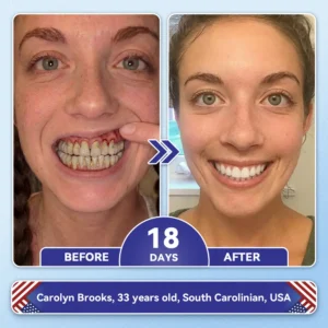 ๐ฅOnline Pharmacy | pureloraยฎ ๐๐๐๐๐๐๐๐ข๐ ๐๐ ๐๐๐๐กโ & ๐บ๐ข๐ ๐
๐๐๐๐๐ ๐น๐๐ ๐ก-๐ท๐๐ ๐ ๐๐๐ฃ๐๐๐ ๐๐๐๐ ๐๐ก๐๐๐๐ ๐ฆท