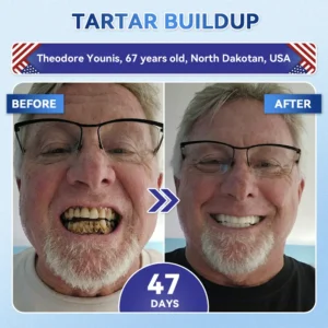 ๐ฅOnline Pharmacy | pureloraยฎ ๐๐๐๐๐๐๐๐ข๐ ๐๐ ๐๐๐๐กโ & ๐บ๐ข๐ ๐
๐๐๐๐๐ ๐น๐๐ ๐ก-๐ท๐๐ ๐ ๐๐๐ฃ๐๐๐ ๐๐๐๐ ๐๐ก๐๐๐๐ ๐ฆท