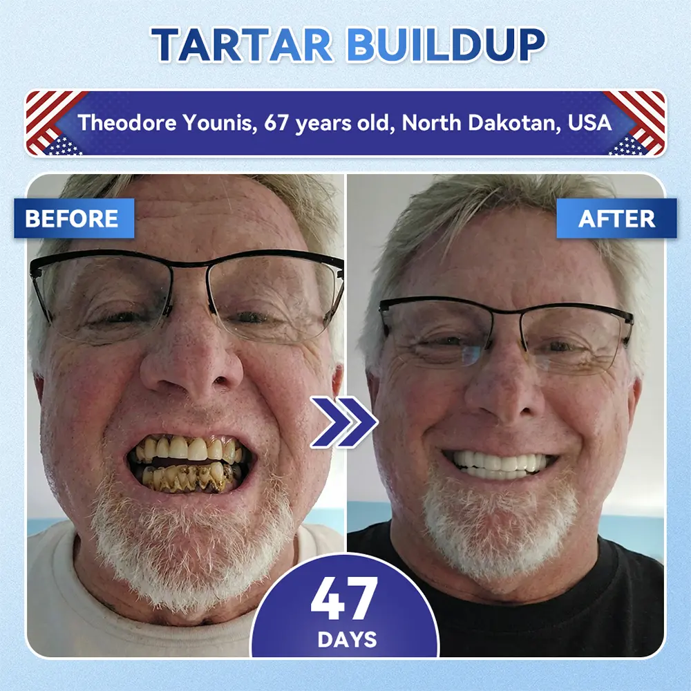 ๐ฅOnline Pharmacy | pureloraยฎ ๐๐๐๐๐๐๐๐ข๐ ๐๐ ๐๐๐๐กโ & ๐บ๐ข๐ ๐
๐๐๐๐๐ ๐น๐๐ ๐ก-๐ท๐๐ ๐ ๐๐๐ฃ๐๐๐ ๐๐๐๐ ๐๐ก๐๐๐๐ ๐ฆท