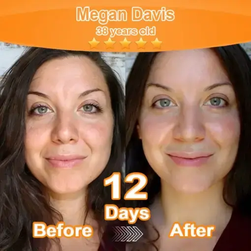 Purelora® Stem Cell Extract EGF and Copper Peptide Revitalizing Essence Cream (deeply activates the skins internal regeneration, making the skin firmer and smoother)