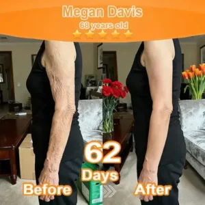 Purelora® Stem Cell Extract EGF and Copper Peptide Revitalizing Essence Cream (deeply activates the skins internal regeneration, making the skin firmer and smoother)