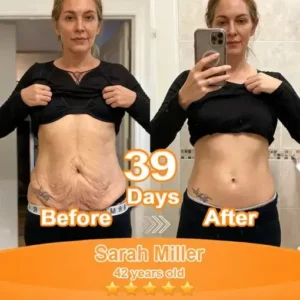 Purelora® Stem Cell Extract EGF and Copper Peptide Revitalizing Essence Cream (deeply activates the skins internal regeneration, making the skin firmer and smoother)