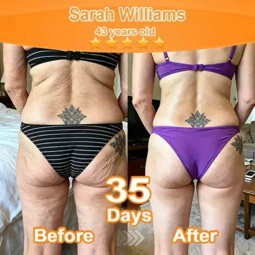 Purelora® Stem Cell Extract EGF and Copper Peptide Revitalizing Essence Cream (deeply activates the skins internal regeneration, making the skin firmer and smoother)