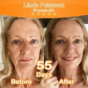 Purelora® Stem Cell Extract EGF and Copper Peptide Revitalizing Essence Cream (deeply activates the skins internal regeneration, making the skin firmer and smoother)