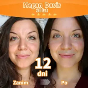 Purelora® Stem Cell Extract EGF and Copper Peptide Revitalizing Essence Cream (głęboko aktywuje wewnętrzną regenerację skóry, sprawia, że staje się ona jędrniejsza i gładsza)