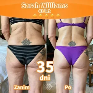 Purelora® Stem Cell Extract EGF and Copper Peptide Revitalizing Essence Cream (głęboko aktywuje wewnętrzną regenerację skóry, sprawia, że staje się ona jędrniejsza i gładsza)