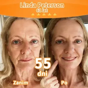 Purelora® Stem Cell Extract EGF and Copper Peptide Revitalizing Essence Cream (głęboko aktywuje wewnętrzną regenerację skóry, sprawia, że staje się ona jędrniejsza i gładsza)