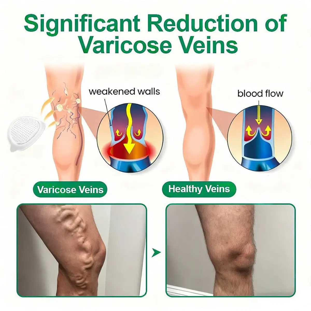 ๐งโโ๏ธ๐๐๐๐ข๐๐ข๐๐ฅ ๐๐ ๐๐ญ๐จ๐ซ๐ | ๐งโโ๏ธ๐๐ฎ๐ซ๐๐ฅ๐จ๐ซ๐ยฎ ๐๐๐ ๐๐๐ง๐จ ๐๐๐๐-๐๐๐๐ ๐ฑ ๐๐๐+ ๐๐๐๐๐๐๐๐๐ ๐๐-๐ข๐ง-๐ ๐๐๐ฏ๐๐ง๐๐๐ ๐๐๐ง๐จ ๐๐ข๐๐ซ๐จ๐ง๐๐๐๐ฅ๐ ๐๐๐ญ๐๐ก โ ๐๐ง๐๐ ๐๐๐ข๐ฅ๐ฒ, ๐๐ข๐ฌ๐ข๐๐ฅ๐ ๐๐๐ฌ๐ฎ๐ฅ๐ญ๐ฌ ๐ข๐ง ๐ ๐๐๐ฒ๐ฌ