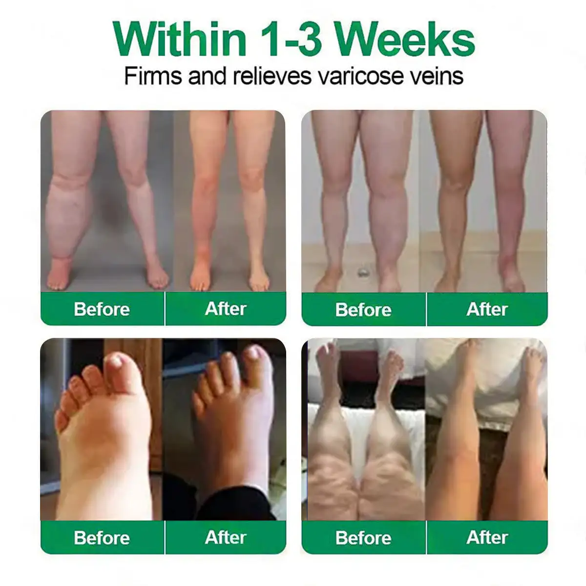 ๐งโโ๏ธ๐๐๐๐ข๐๐ข๐๐ฅ ๐๐ ๐๐ญ๐จ๐ซ๐ | ๐งโโ๏ธ๐๐ฎ๐ซ๐๐ฅ๐จ๐ซ๐ยฎ ๐๐๐ ๐๐๐ง๐จ ๐๐๐๐-๐๐๐๐ ๐ฑ ๐๐๐+ ๐๐๐๐๐๐๐๐๐ ๐๐-๐ข๐ง-๐ ๐๐๐ฏ๐๐ง๐๐๐ ๐๐๐ง๐จ ๐๐ข๐๐ซ๐จ๐ง๐๐๐๐ฅ๐ ๐๐๐ญ๐๐ก โ ๐๐ง๐๐ ๐๐๐ข๐ฅ๐ฒ, ๐๐ข๐ฌ๐ข๐๐ฅ๐ ๐๐๐ฌ๐ฎ๐ฅ๐ญ๐ฌ ๐ข๐ง ๐ ๐๐๐ฒ๐ฌ