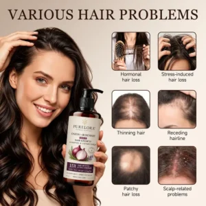 🌿👨‍⚕️ Official US Store 🇺🇸 | 🔥 PURELORA® Onion & Rosemary 2-in-1 Shampoo & Conditioner with 15X Active Complex for Hair Growth: For hair that looks thicker, fuller, and stronger