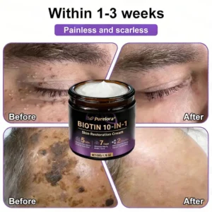 Made and Shipped from the USA 🍁 Purelora® Biotin 10-in-1 Skin Repair Cream — Last Day of Sale: 75% Off