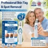 Purelora® 7-𝐷𝑎𝑦 𝗧𝐚𝐠 & 𝗦𝗽𝐨𝐭 𝐄𝐫𝒂𝒔𝒆𝒓(Zero Pain, Zero 𝐒𝐜𝐚𝒓𝒔 Rollerball)