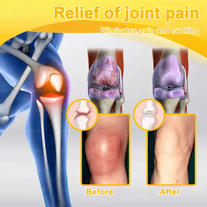 Purelora®💞💞 Bee Venom Pain-Relief Bone Healing Cream (Specially for older adults)