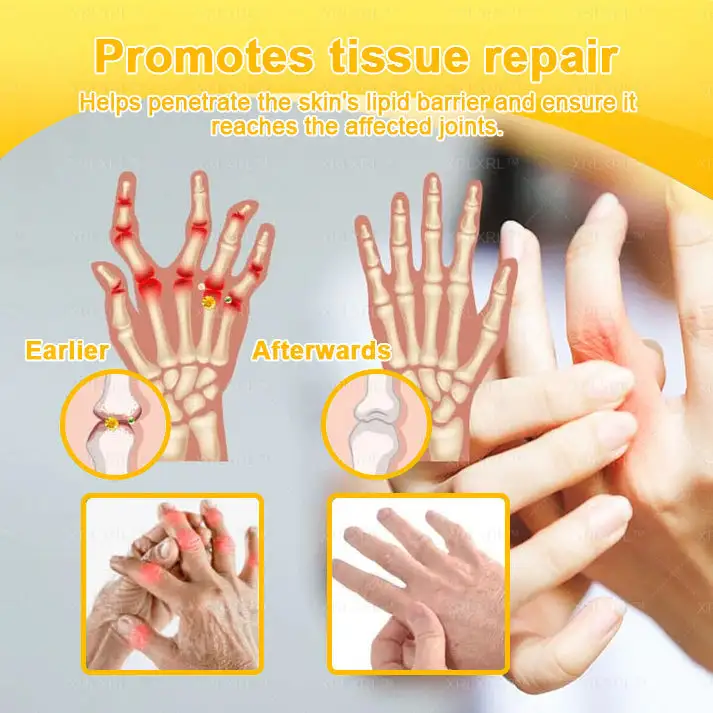 Purelora®💞💞 Bee Venom Pain-Relief Bone Healing Cream (Specially for older adults)