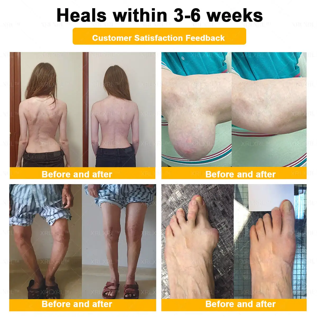 Purelora®💞💞 Bee Venom Pain-Relief Bone Healing Cream (Specially for older adults)