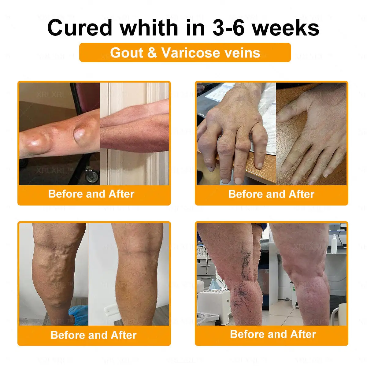 Purelora®💞💞 Bee Venom Pain-Relief Bone Healing Cream (Specially for older adults)