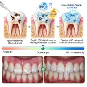 Purelora® CavityReverse Pept11 MicroFill Gel