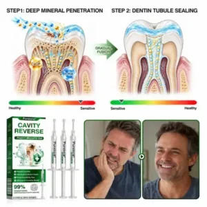 Purelora® CavityReverse Pept11 MicroFill Gel