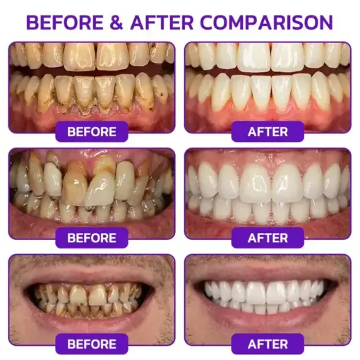 Purelora® VioGum Gingivitis & Periodontal Rescue Gel
