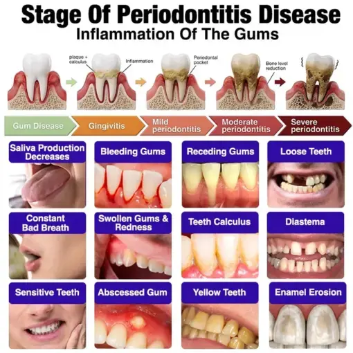 Purelora® VioGum Gingivitis & Periodontal Rescue Gel